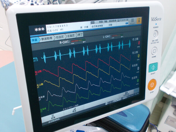 血圧脈波検査